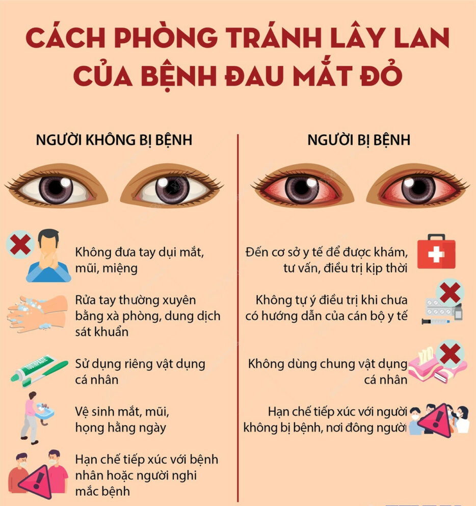 Cach Phong Dau Mat Do Lmnx