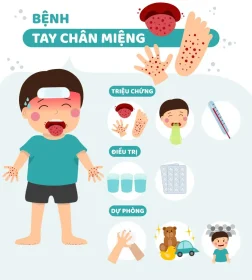 BÀI TRUYỀN THÔNG PHÒNG CHỐNG BỆNH “TAY – CHÂN – MIỆNG”